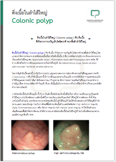 มะเร็งลำไส้ใหญ่และทวารหนัก