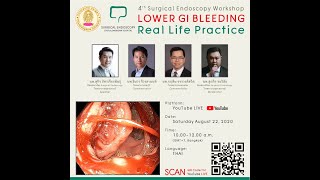Lower GI Bleeding : Real Life Practice